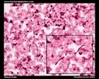 streptococcus mitis